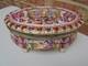 Antique Vintage Capodimonte Italy Lg Footed Hinged Box Jewelry Casket 8 1/4